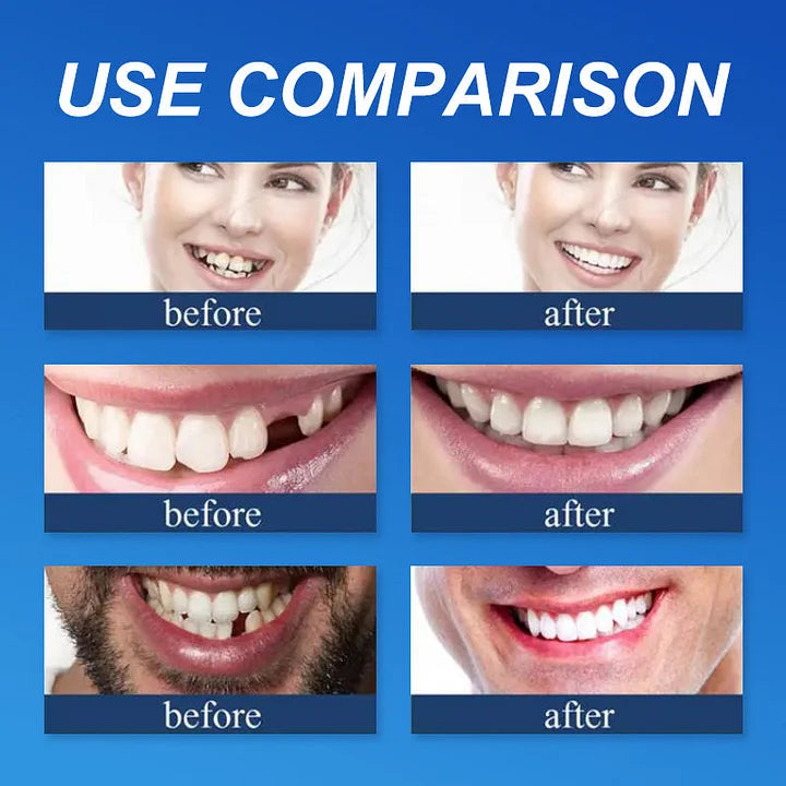 Ends Today: 70% OFF! ⏰tzeternity™ Medical Full Denture with Strong Suctiond Custom-Fit Full Functional Dentures🦷Obtain American Dental Association (ADA) Certification
